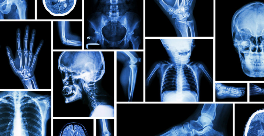 Best Radiology Treatment in Abhanpur